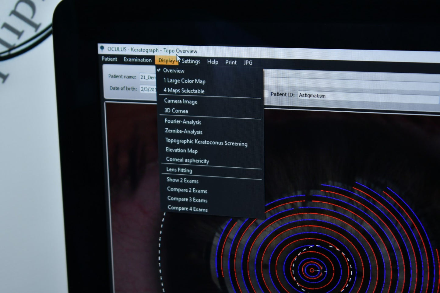 Oculus Keratograph 5M loaded with dry eye and refractive licenses