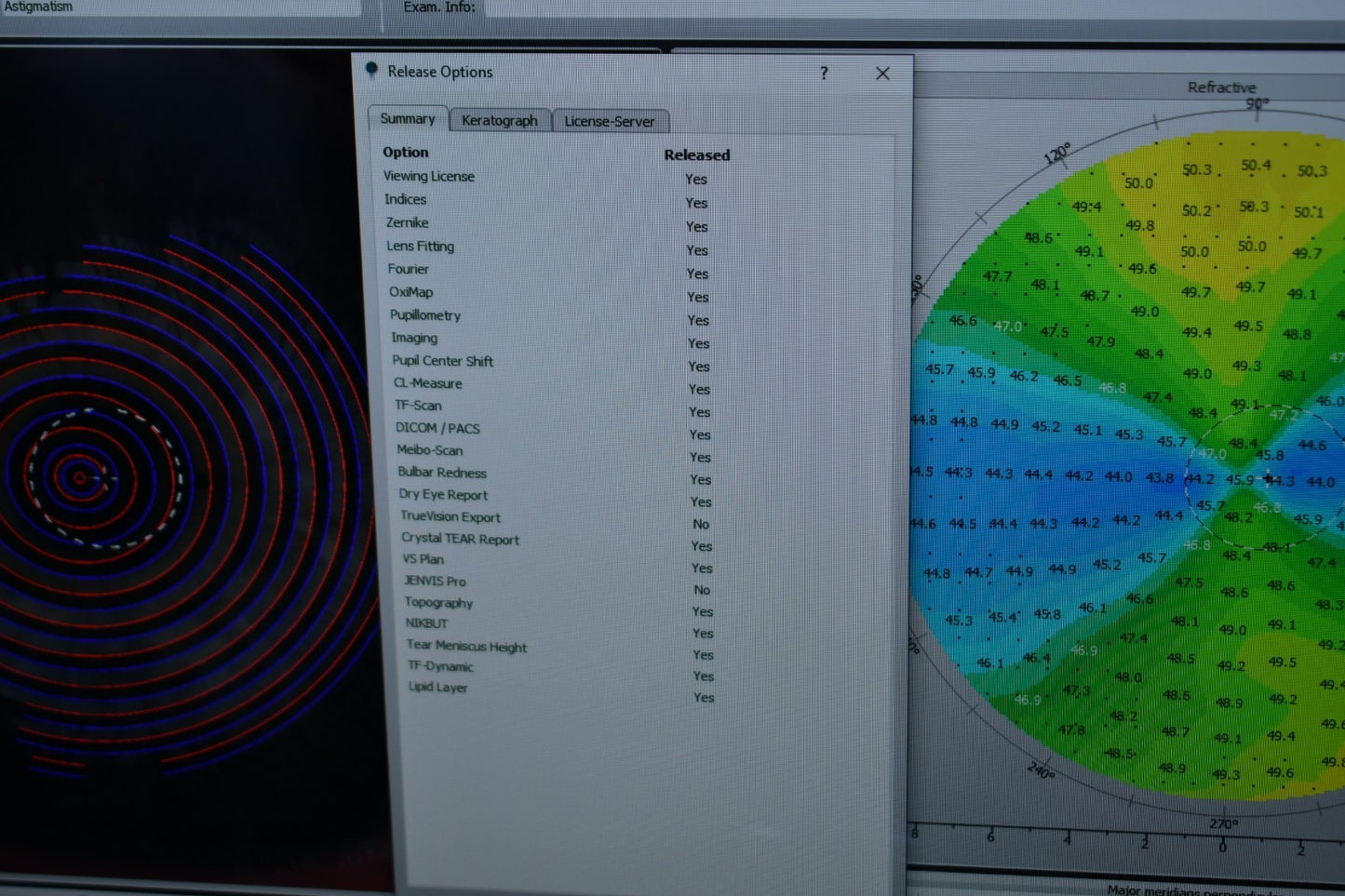 Oculus Keratograph 5M loaded with dry eye and refractive licenses