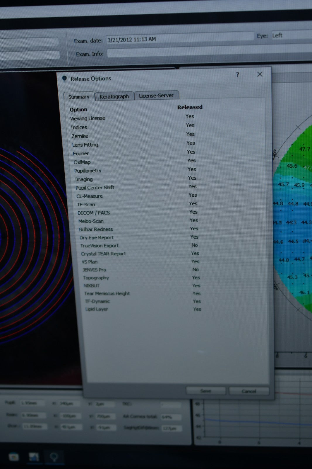 Oculus Keratograph 5M loaded with dry eye and refractive licenses