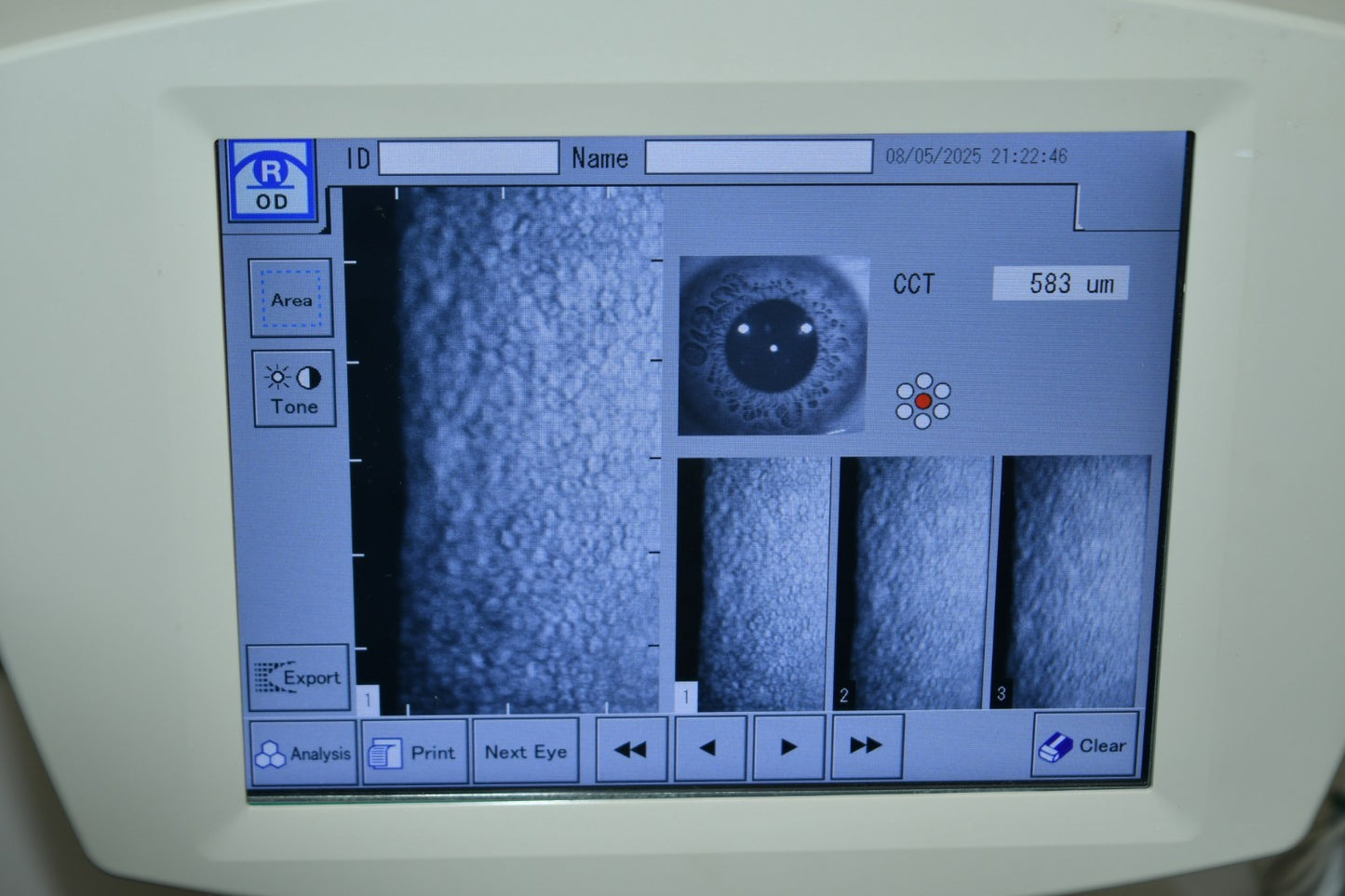 Tomey EM-3000 Specular endothelial microscope
