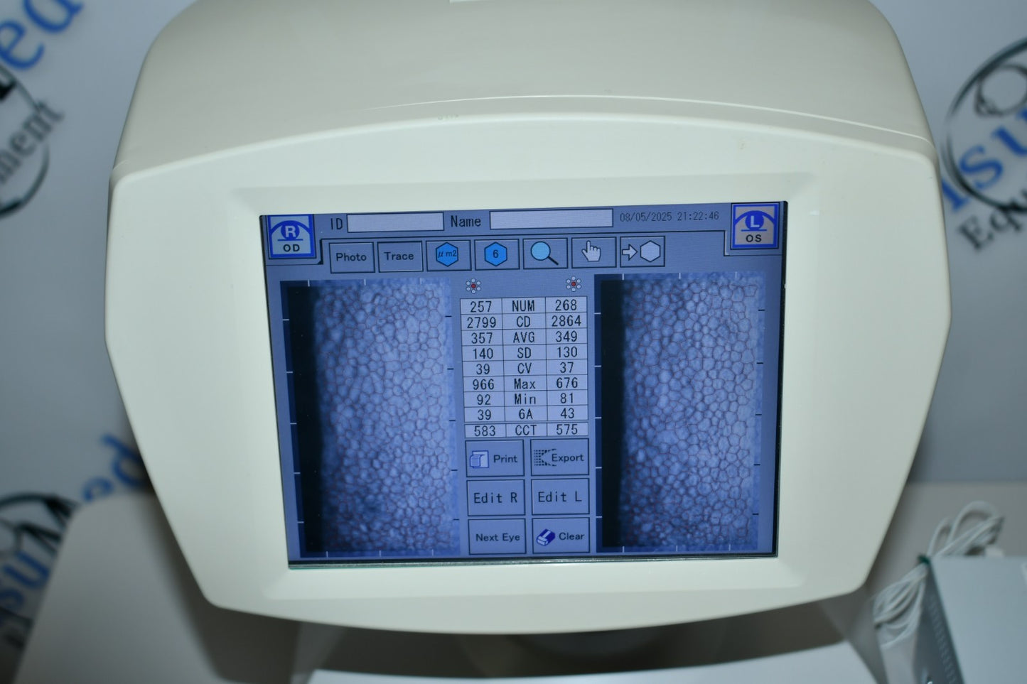 Tomey EM-3000 Specular endothelial microscope