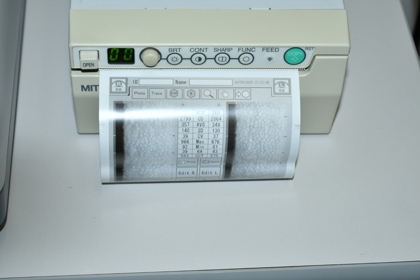 Tomey EM-3000 Specular endothelial microscope