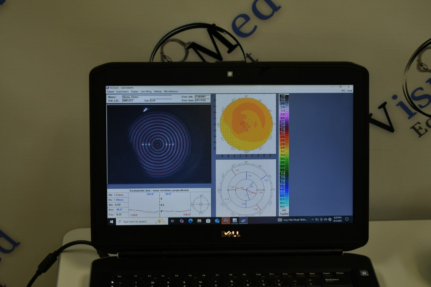 Oculus Easygraph Corneal topographer portable and slitlamp mountable