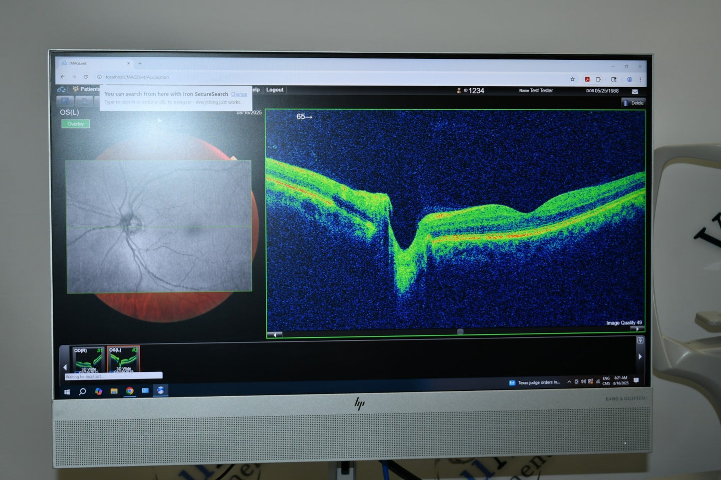 Topcon 3D OCT Maestro2 OCT with ImageNET 6 Win 11