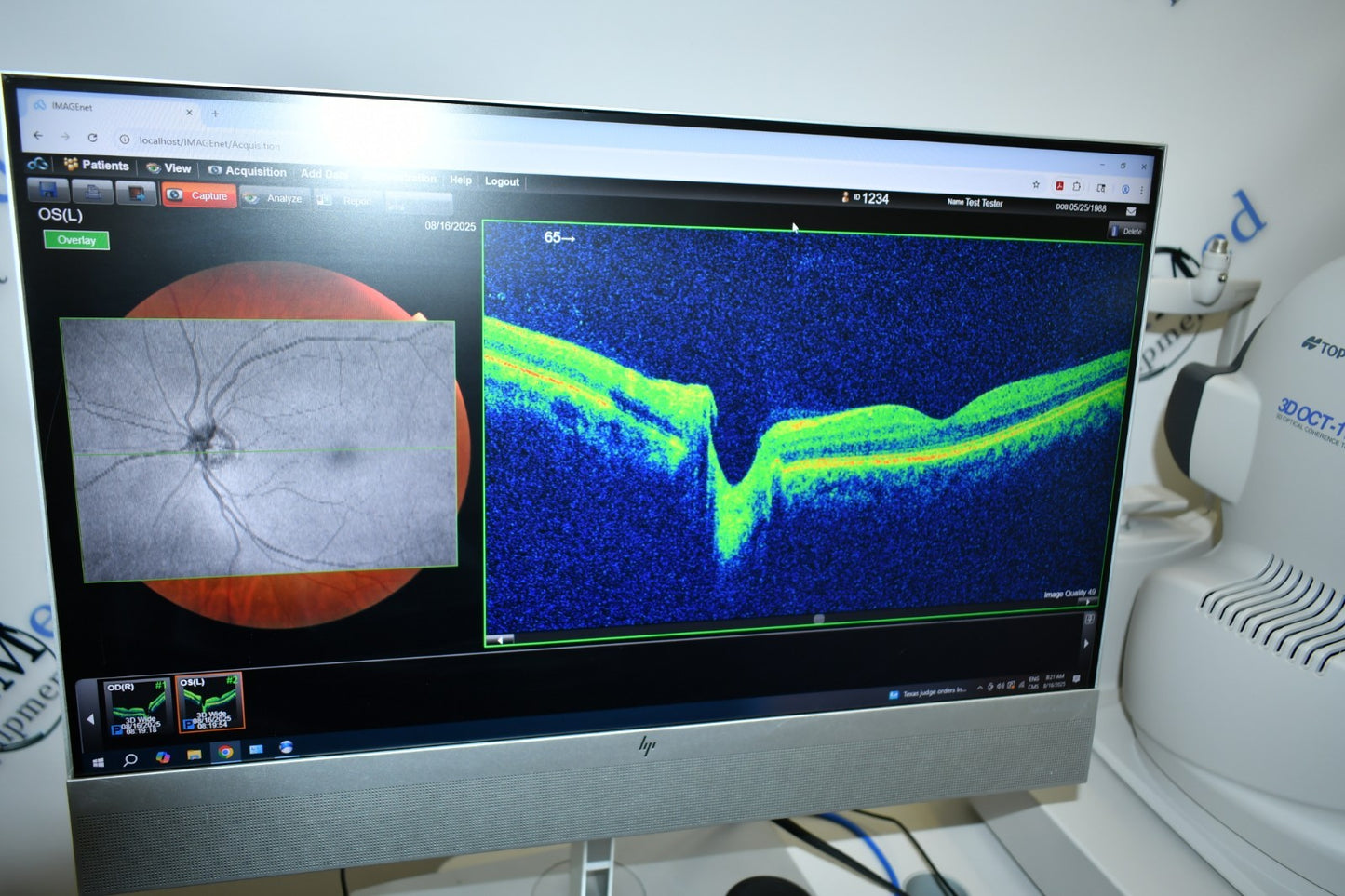 Topcon 3D OCT Maestro2 OCT with ImageNET 6 Win 11