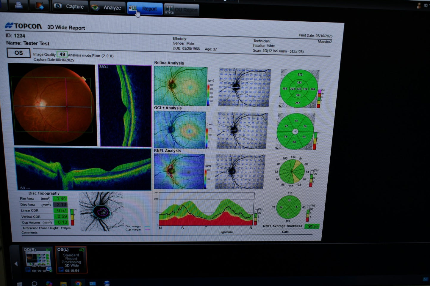 Topcon 3D OCT Maestro2 OCT with ImageNET 6 Win 11