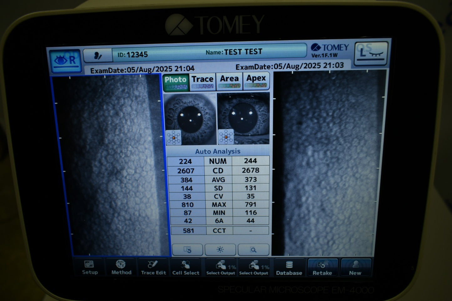 Tomey EM-4000 Specular endothelial microscope