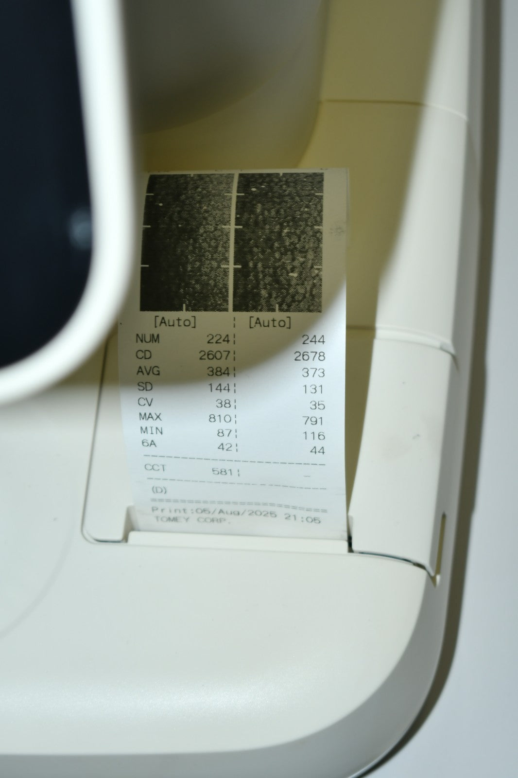 Tomey EM-4000 Specular endothelial microscope