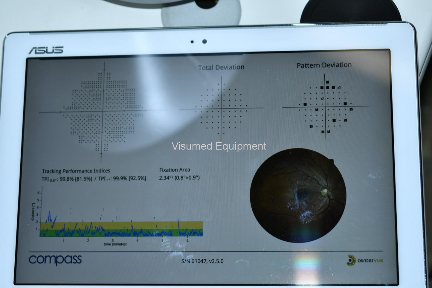 Icare Centervue Compass perimeter fundus camera visual field