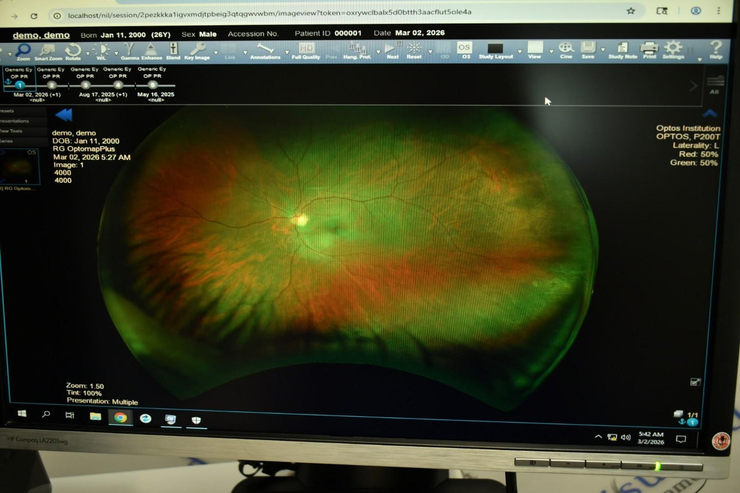 Optos Daytona plus Fundus Camera w/ Auto-Fluorescence - OptosAdvance Software