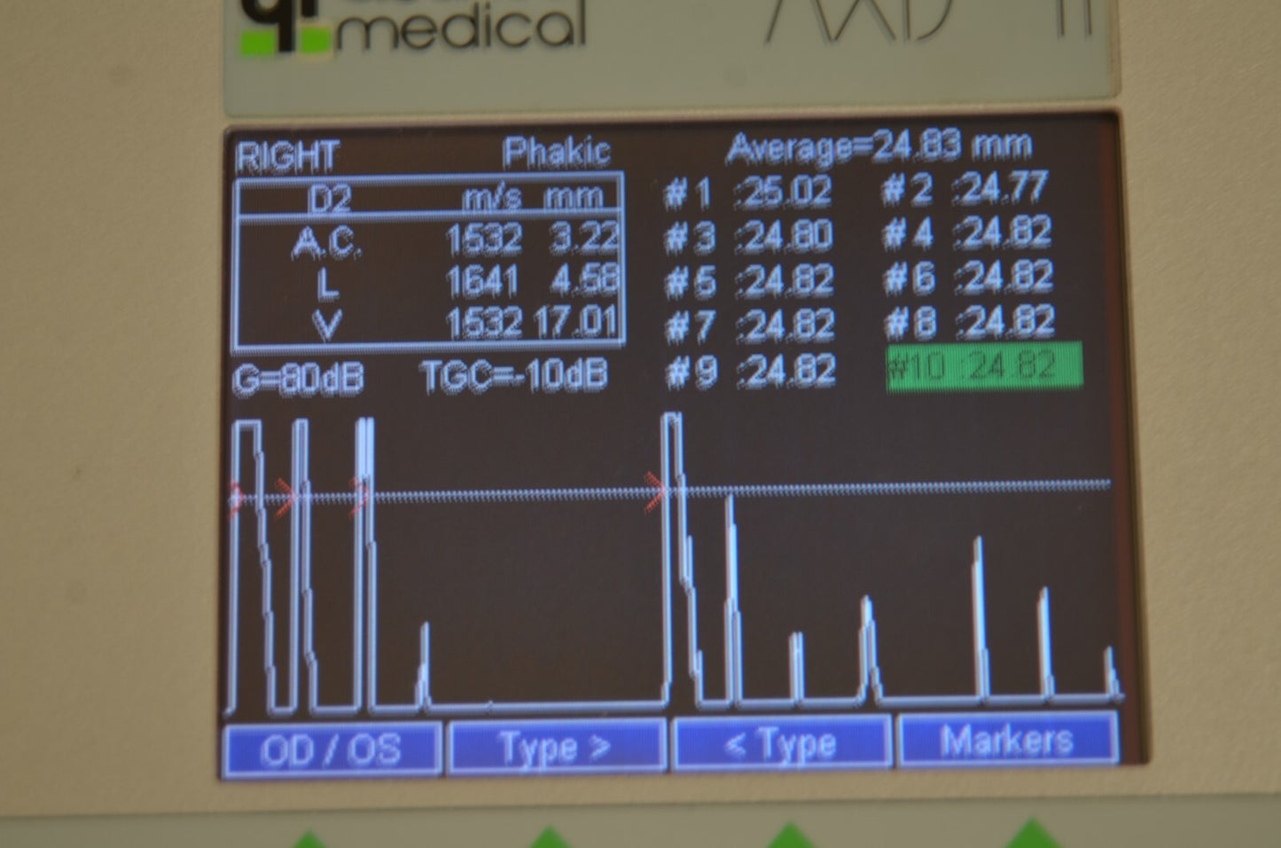 Refurbished QUANTEL MEDICAL AXIS II Ultrasound A-Scan Biometer offered by Visumed Equipment