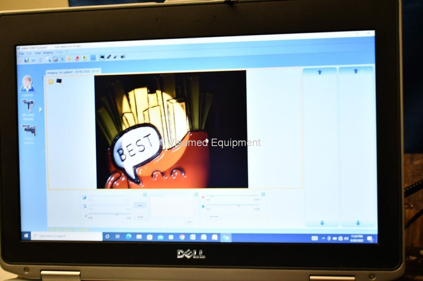 Haag Streit BD-900 photoslitlamp with laptop and software