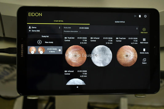 iCare EIDON widefield TrueColor confocal fundus imaging