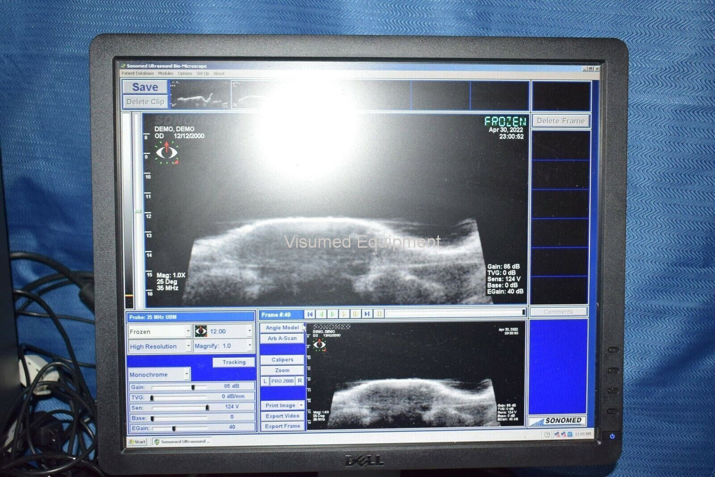 Refurbished Sonomed Vumax II UBM Ophthalmic Ultrasound Biomicroscopy Glaucoma offered by Visumed Equipment