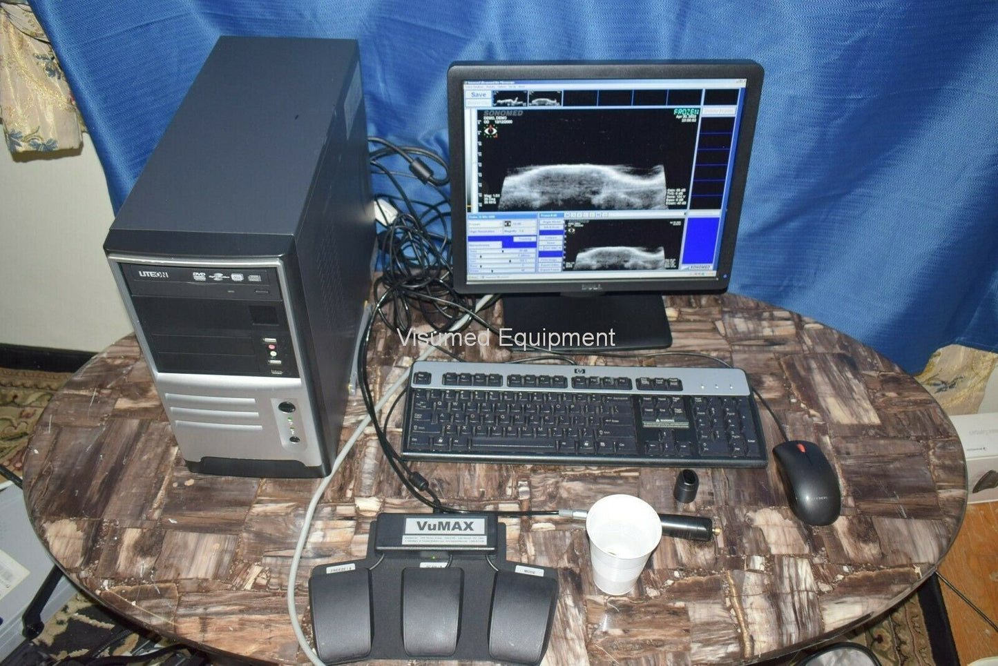 Refurbished Sonomed Vumax II UBM Ophthalmic Ultrasound Biomicroscopy Glaucoma offered by Visumed Equipment