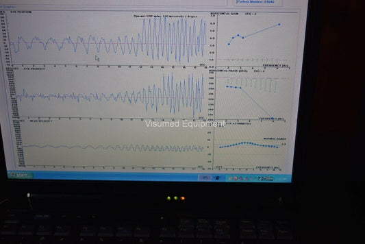 Refurbished Western Systems Research WSR VAT/ENG Plus Combo with laptop - Software offered by Visumed Equipment