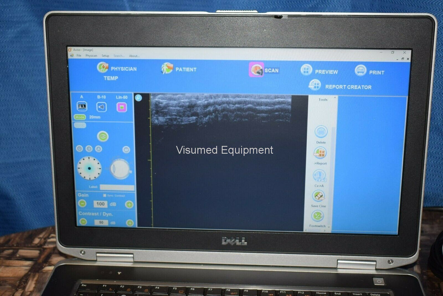 Refurbished Quantel Aviso UBM ophthalmic ultrasound offered by Visumed Equipment