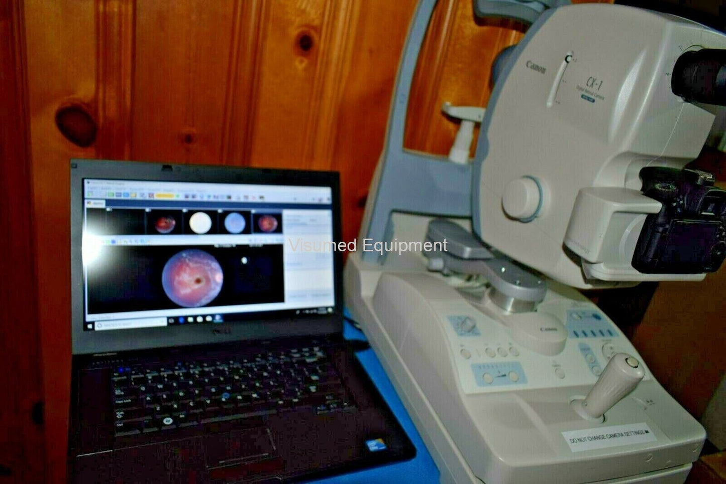 Refurbished Canon CX-1 Fundus retinal camera non-myd/mydriatic FAF Fluorescein FFA offered by Visumed Equipment