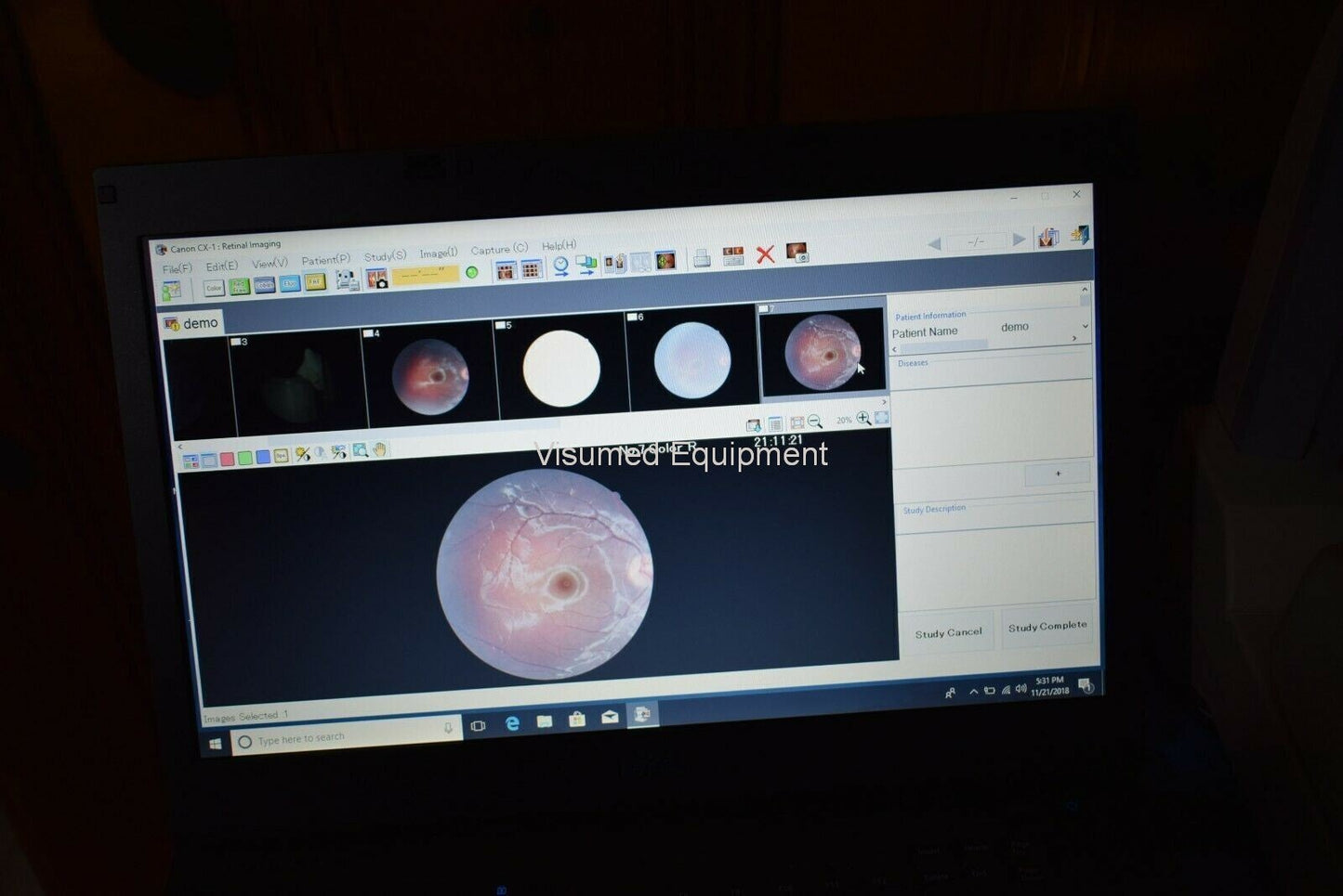 Refurbished Canon CX-1 Fundus retinal camera non-myd/mydriatic FAF Fluorescein FFA offered by Visumed Equipment