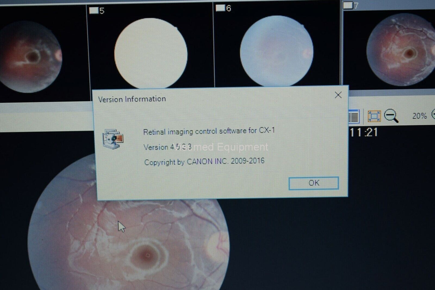 Refurbished Canon CX-1 Fundus retinal camera non-myd/mydriatic FAF Fluorescein FFA offered by Visumed Equipment