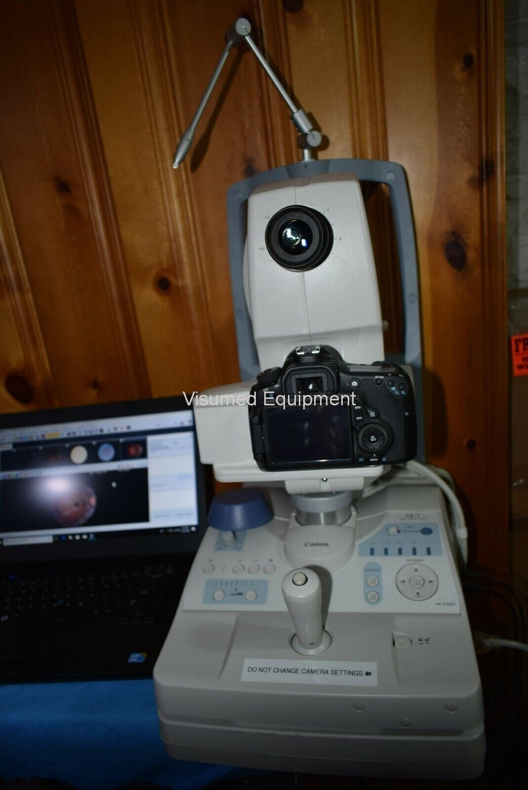 Refurbished Canon CX-1 Fundus retinal camera non-myd/mydriatic FAF Fluorescein FFA offered by Visumed Equipment