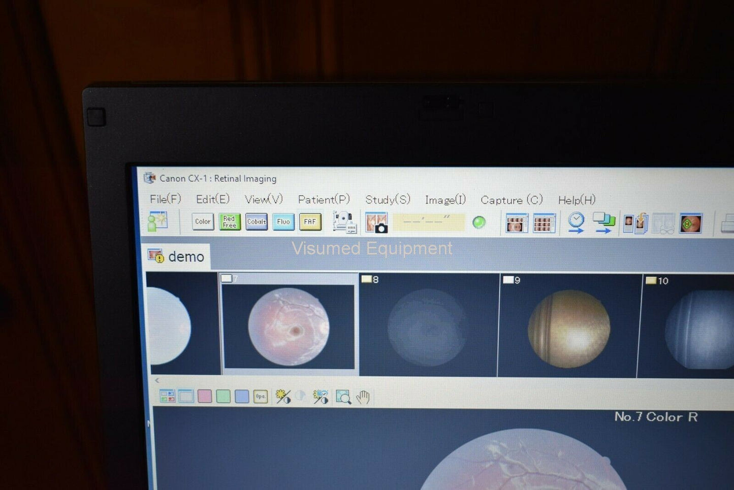 Refurbished Canon CX-1 Fundus retinal camera non-myd/mydriatic FAF Fluorescein FFA offered by Visumed Equipment