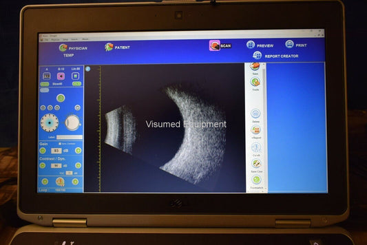 Refurbished Quantel Aviso Bscan UBM ophthalmic ultrasound offered by Visumed Equipment