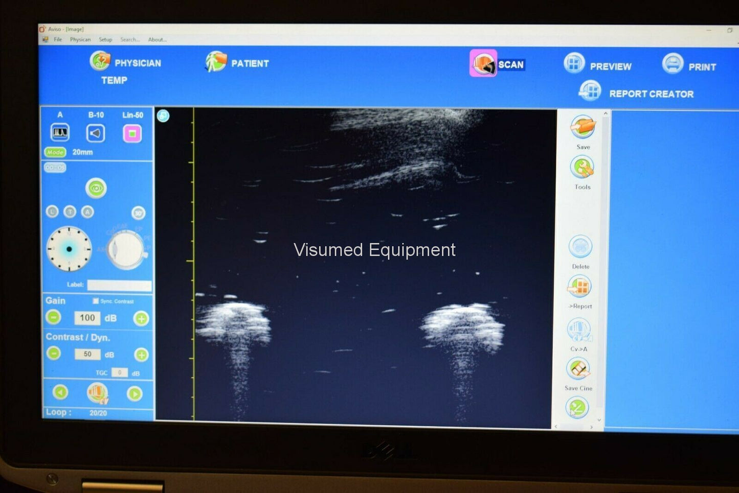 Refurbished Quantel Aviso Bscan UBM ophthalmic ultrasound offered by Visumed Equipment