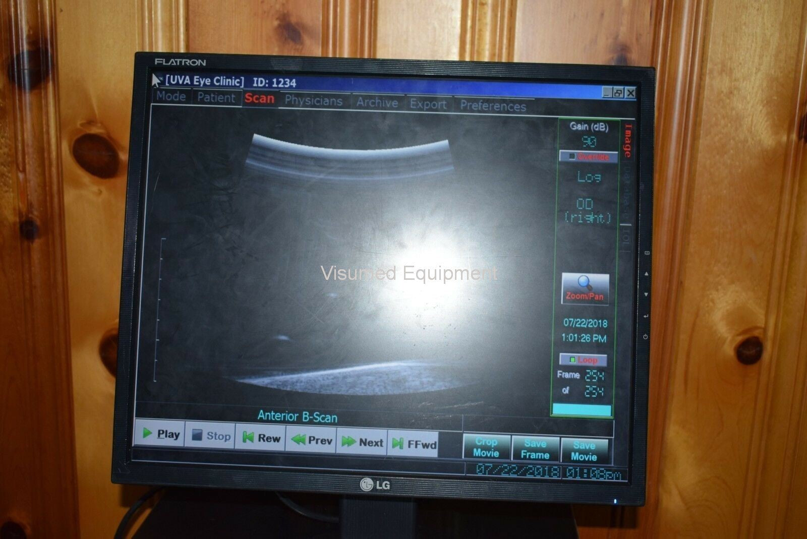 Refurbished Ellex Eyecubed  ultrasound biomicroscopy (UBM) unit offered by Visumed Equipment