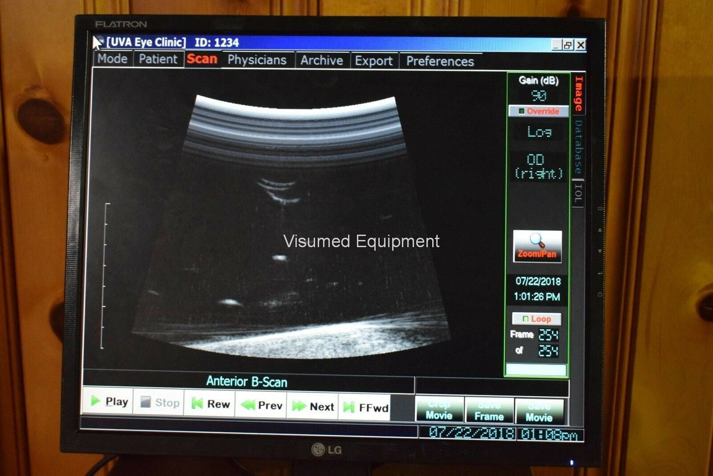 Refurbished Ellex Eyecubed  ultrasound biomicroscopy (UBM) unit offered by Visumed Equipment