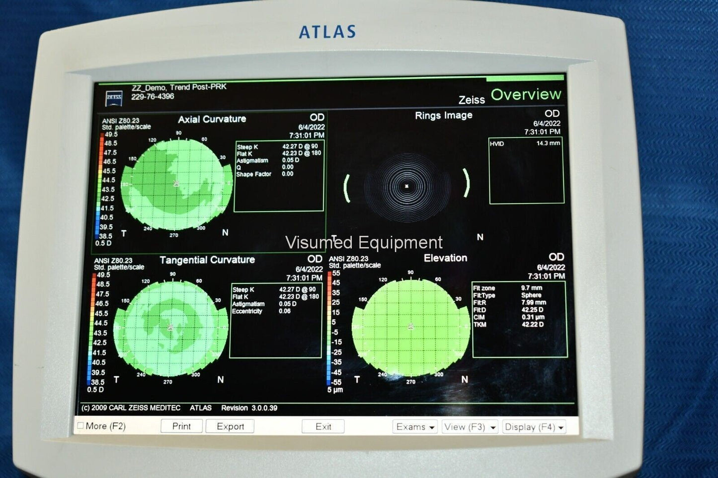 Refurbished ZEISS Atlas 9000 Corneal Topographer System offered by Visumed Equipment