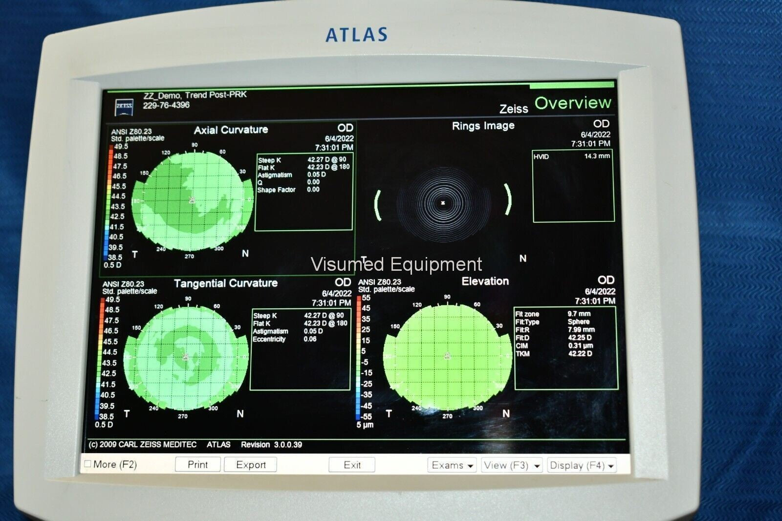 Refurbished ZEISS Atlas 9000 Corneal Topographer System offered by Visumed Equipment