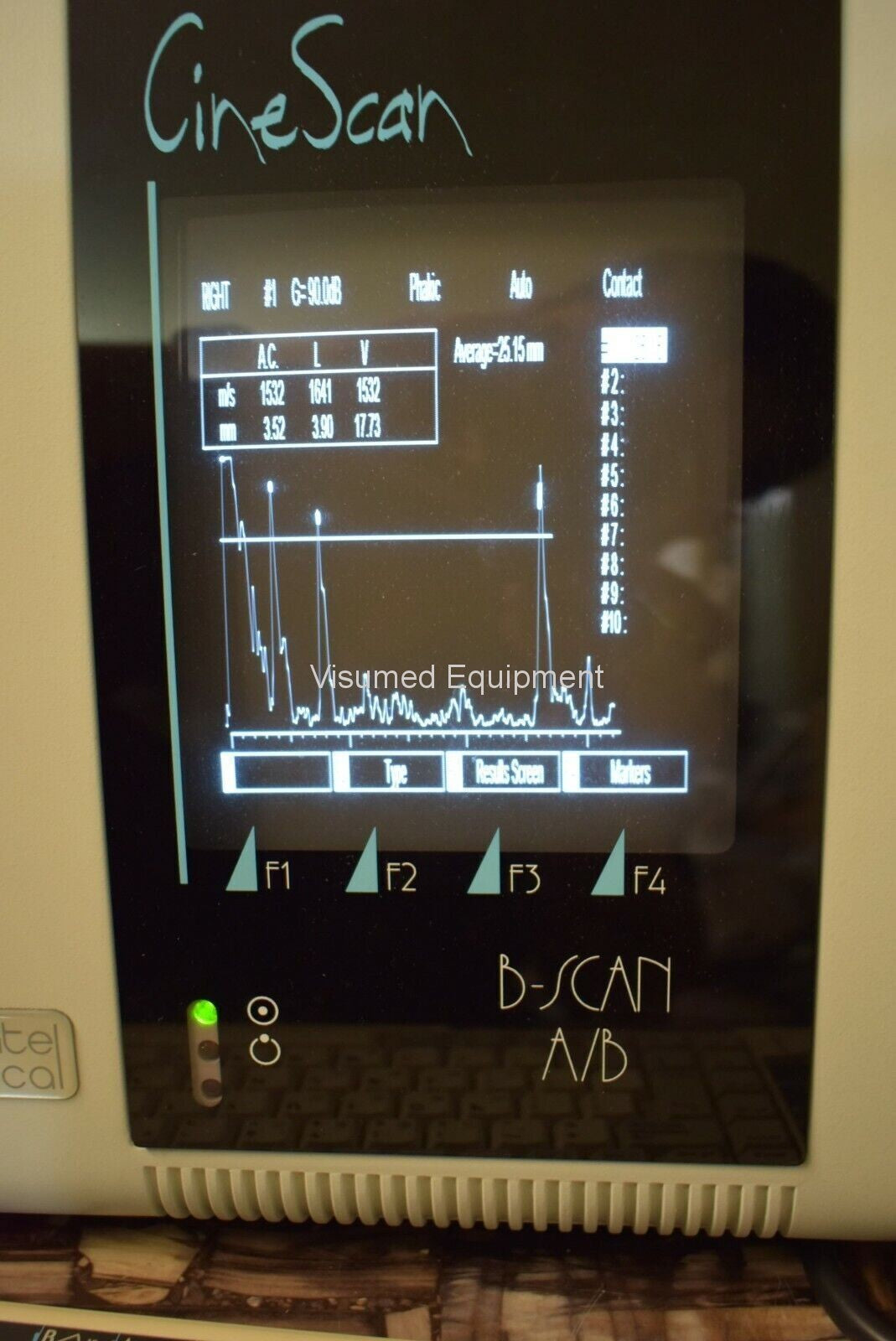 Refurbished Quantel CineScan B-Scan A/B Scan Ophthalmic Ultrasound offered by Visumed Equipment