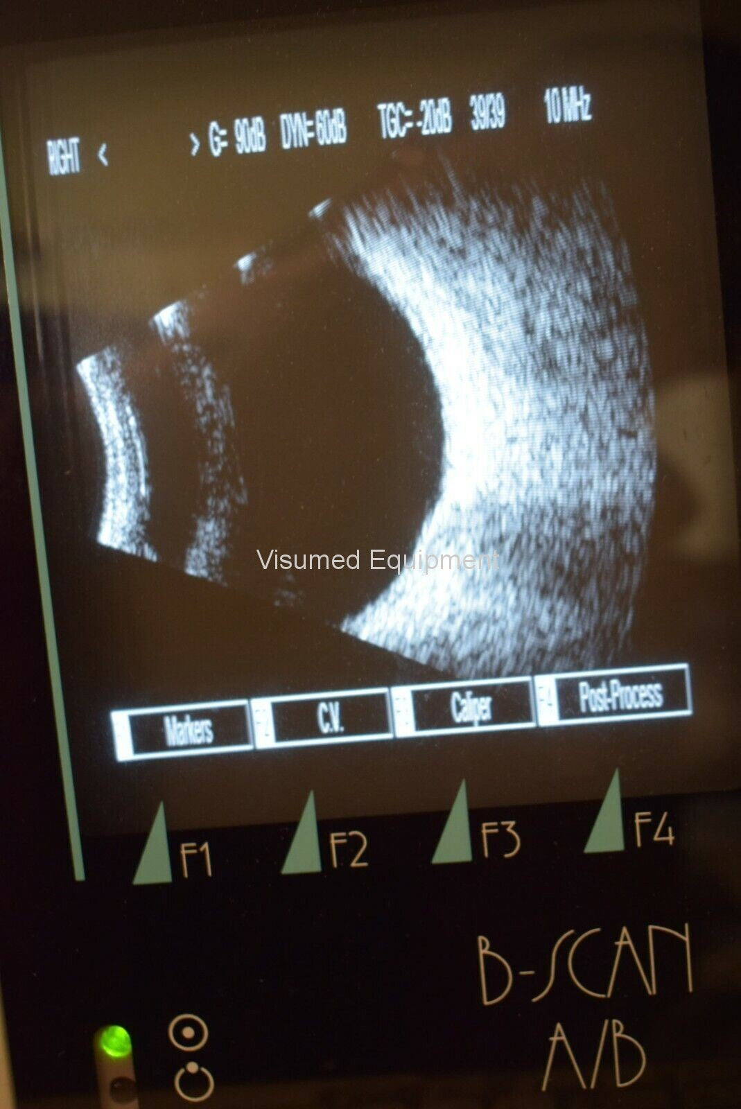 Refurbished Quantel CineScan B-Scan A/B Scan Ophthalmic Ultrasound offered by Visumed Equipment