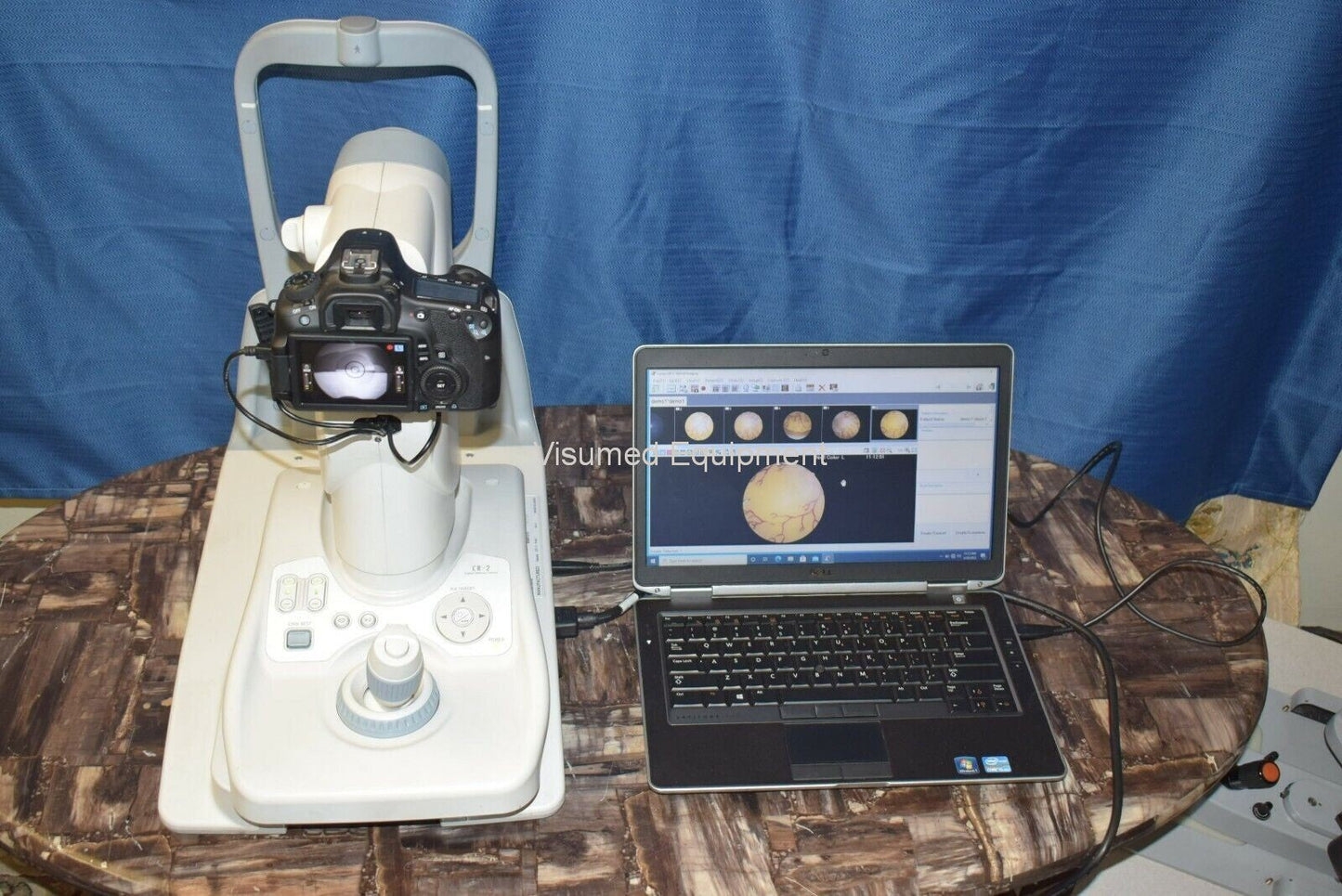Refurbished Canon CR-2 Retinal Camera. Refurbished. New dell laptop windows 10 offered by Visumed Equipment