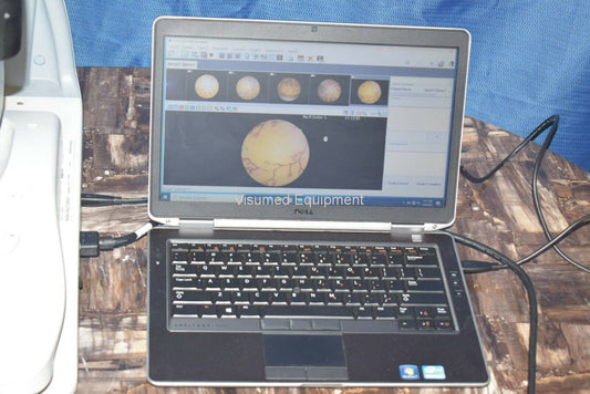 Refurbished Canon CR-2 Retinal Camera. Refurbished. New dell laptop windows 10 offered by Visumed Equipment