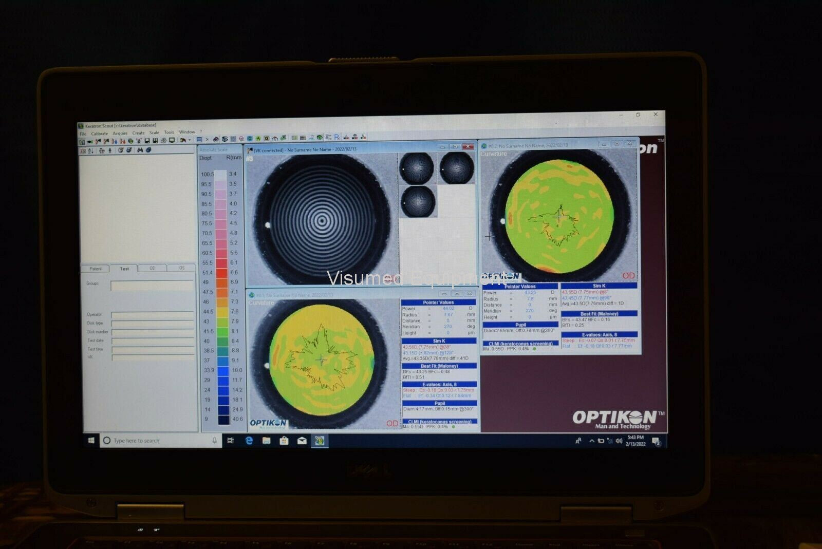Refurbished Optikon Keratron Scout Corneal Topographer offered by Visumed Equipment