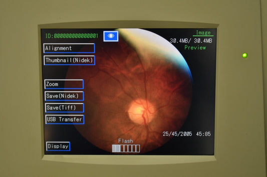 Refurbished Nidek Handy NM-200D non-mydriatic Fundus Camera offered by Visumed Equipment