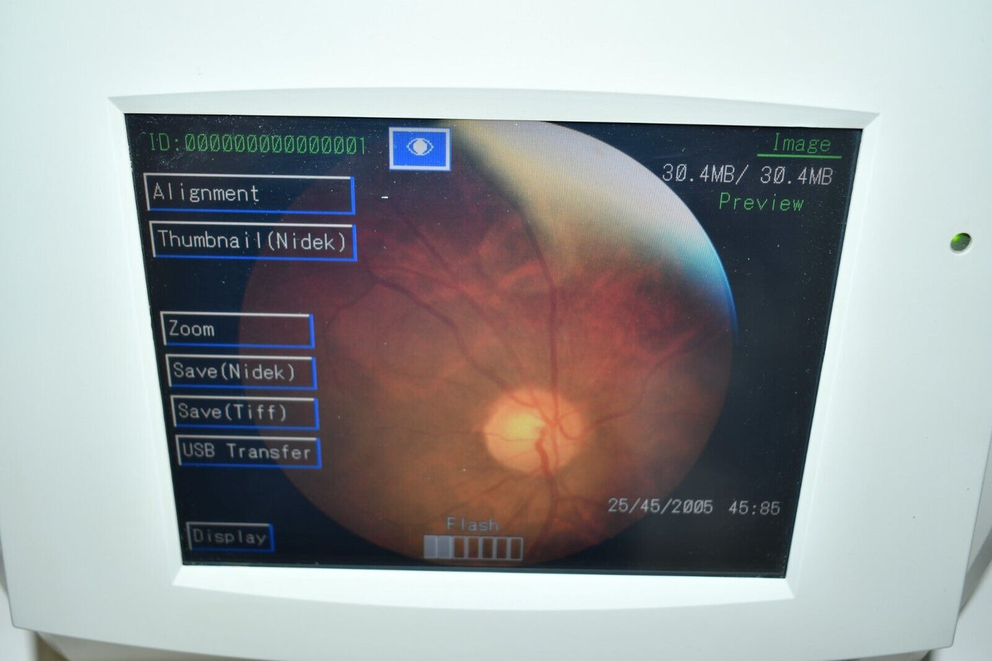 Refurbished Nidek Handy NM-200D non-mydriatic Fundus Camera offered by Visumed Equipment