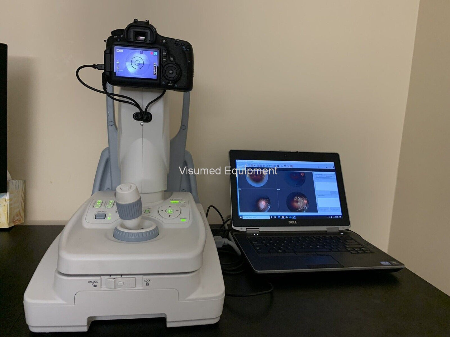 Refurbished Canon CR-2 Plus AF Camera Autofocus Fundus Autofluorescence offered by Visumed Equipment