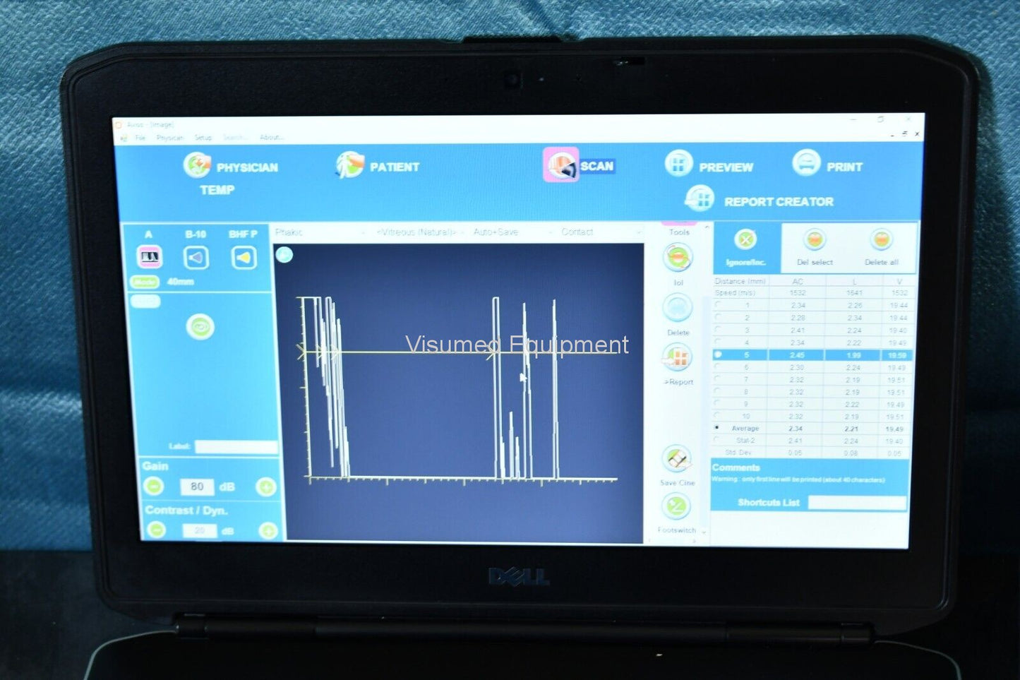 Refurbished Quantel Medical Aviso A and B scan Ultrasound complete offered by Visumed Equipment