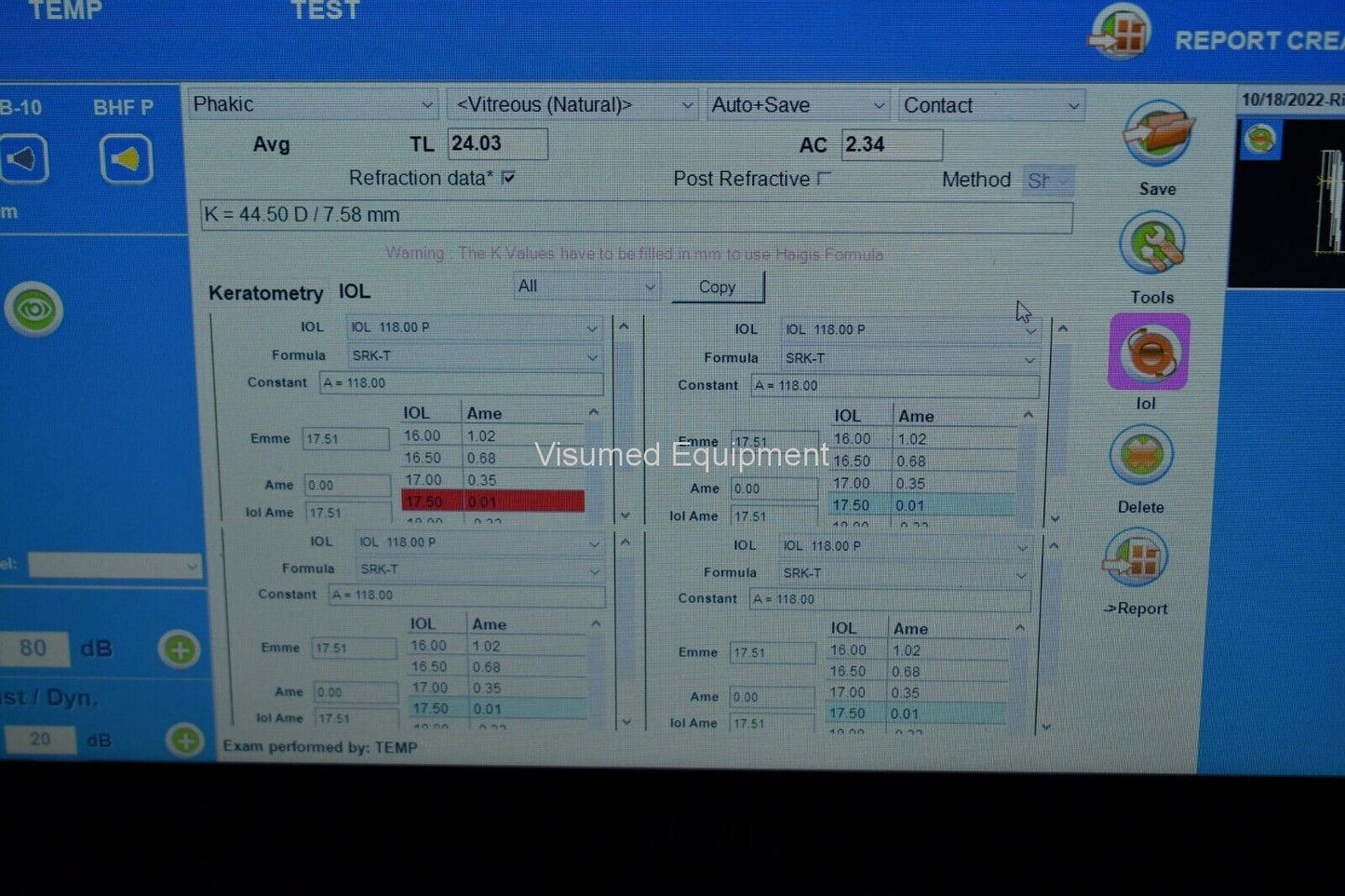 Refurbished Quantel Medical Aviso A and B scan Ultrasound complete offered by Visumed Equipment