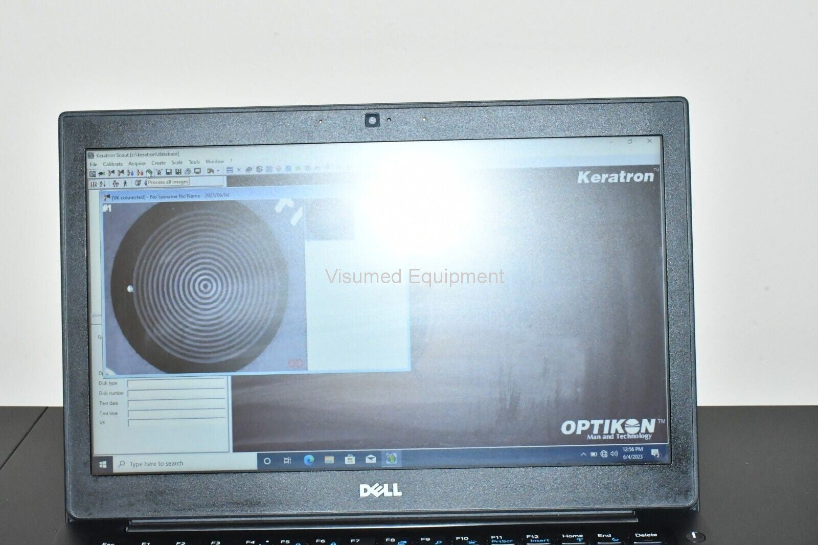 Refurbished Optikon Keratron Scout portable Corneal Topographer offered by Visumed Equipment
