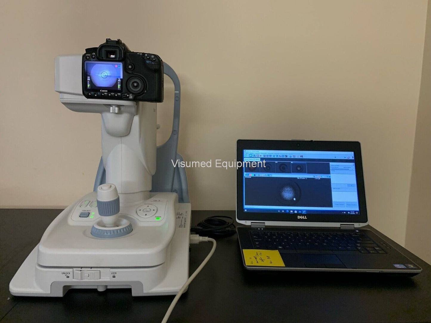 Refurbished Canon CR-2 Retinal Camera +dell laptop windows 10 & Canon Software offered by Visumed Equipment