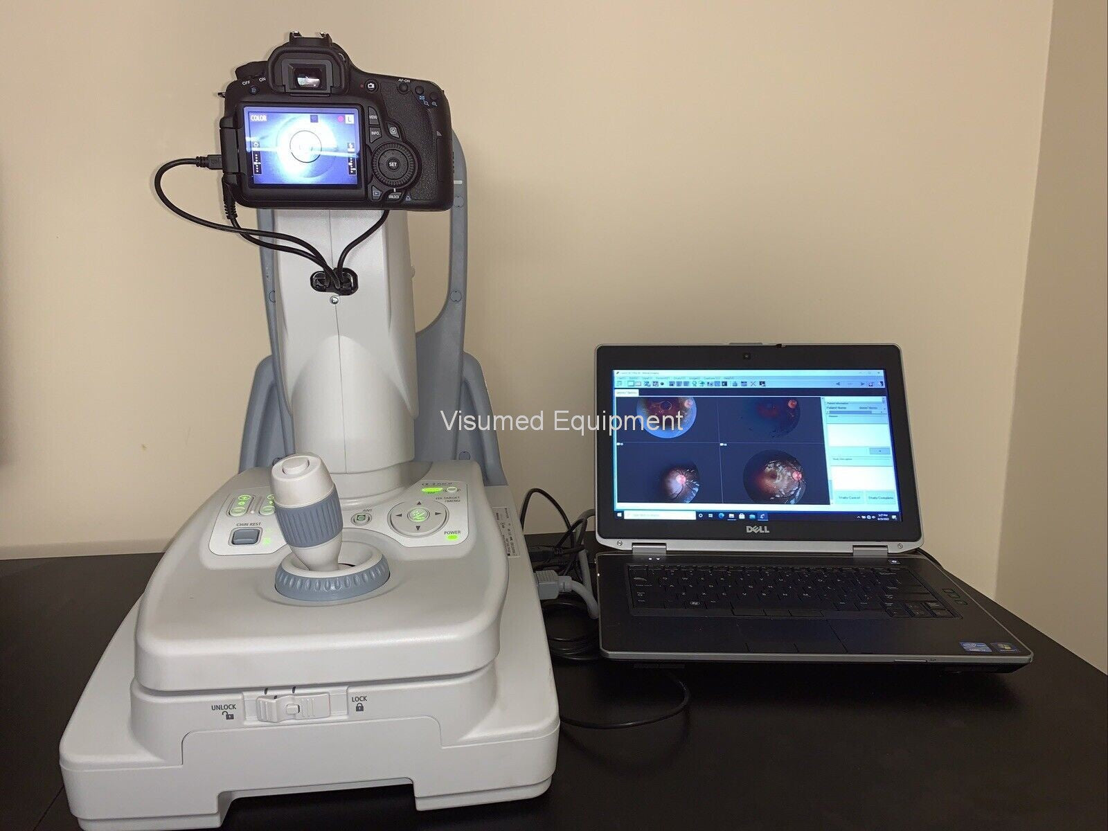 Refurbished Canon CR-2 Plus AF Camera Autofocus Fundus Autofluorescence offered by Visumed Equipment