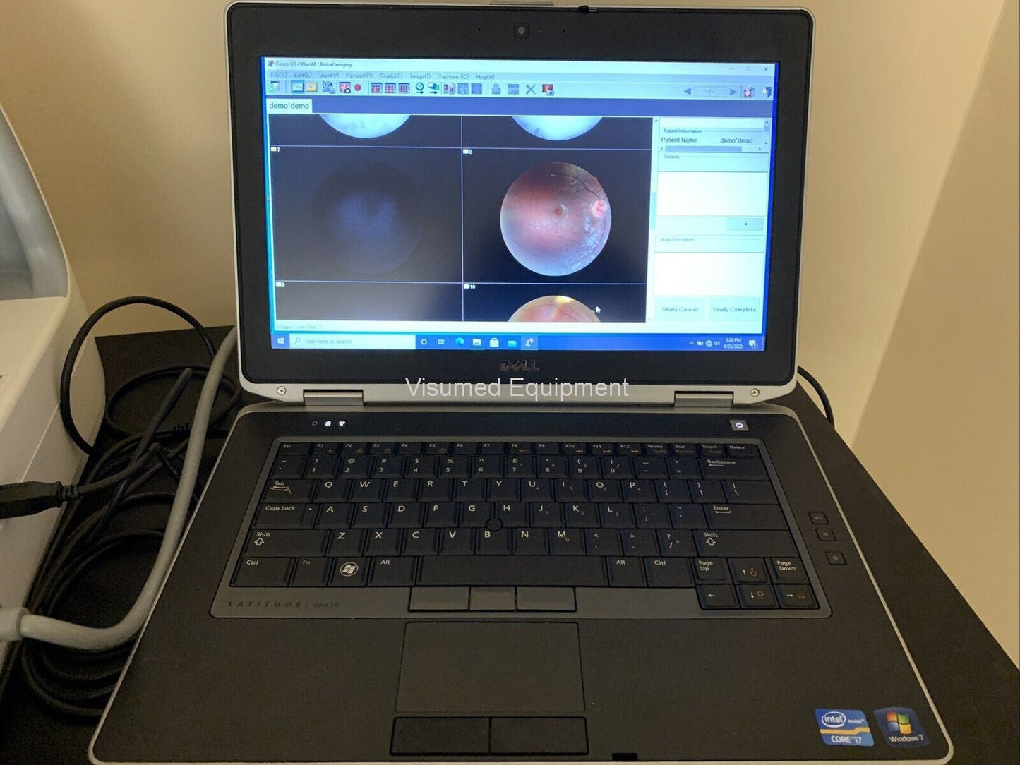 Refurbished Canon CR-2 Plus AF Camera Autofocus Fundus Autofluorescence offered by Visumed Equipment
