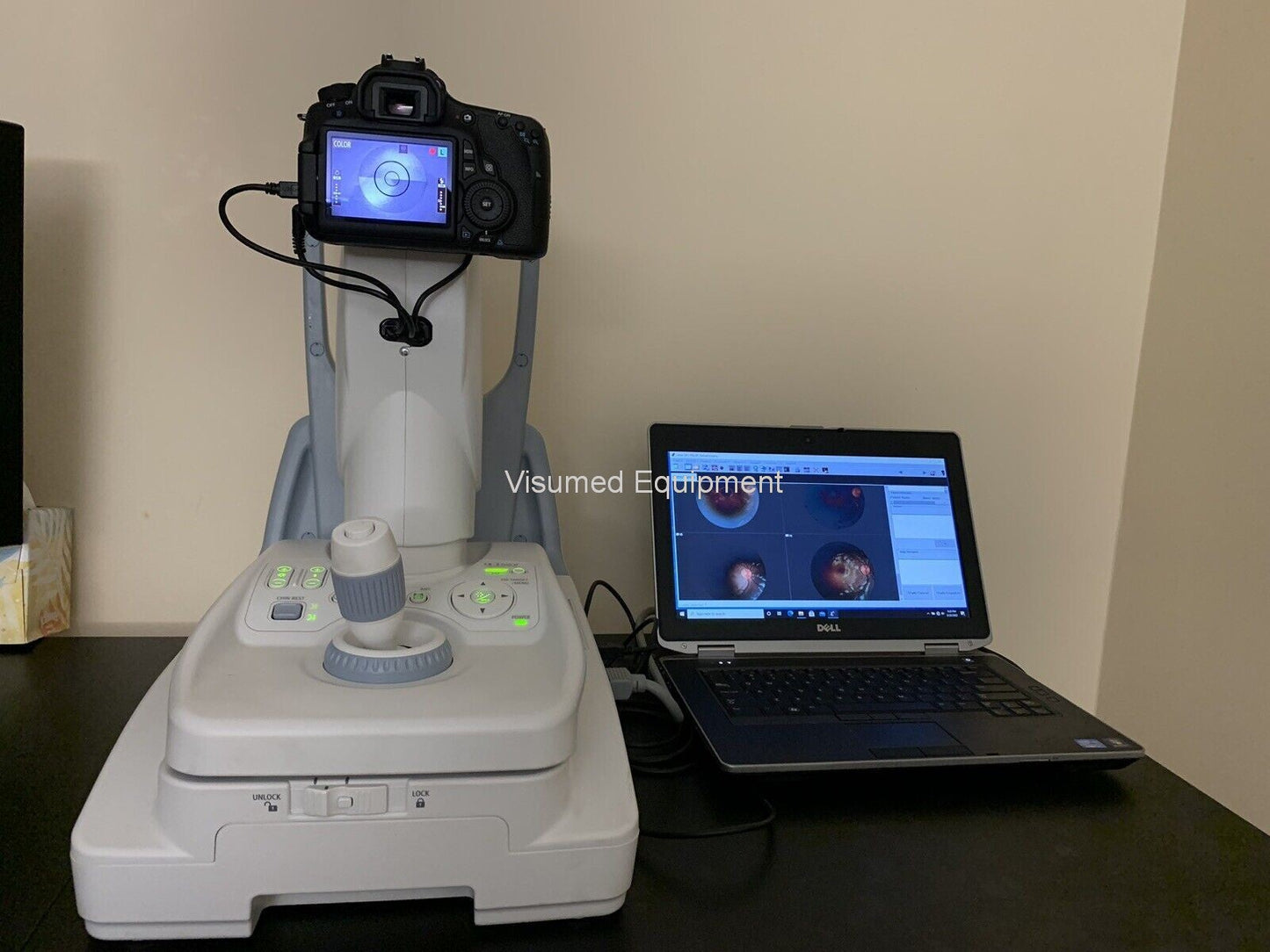Refurbished Canon CR-2 Plus AF Camera Autofocus Fundus Autofluorescence offered by Visumed Equipment