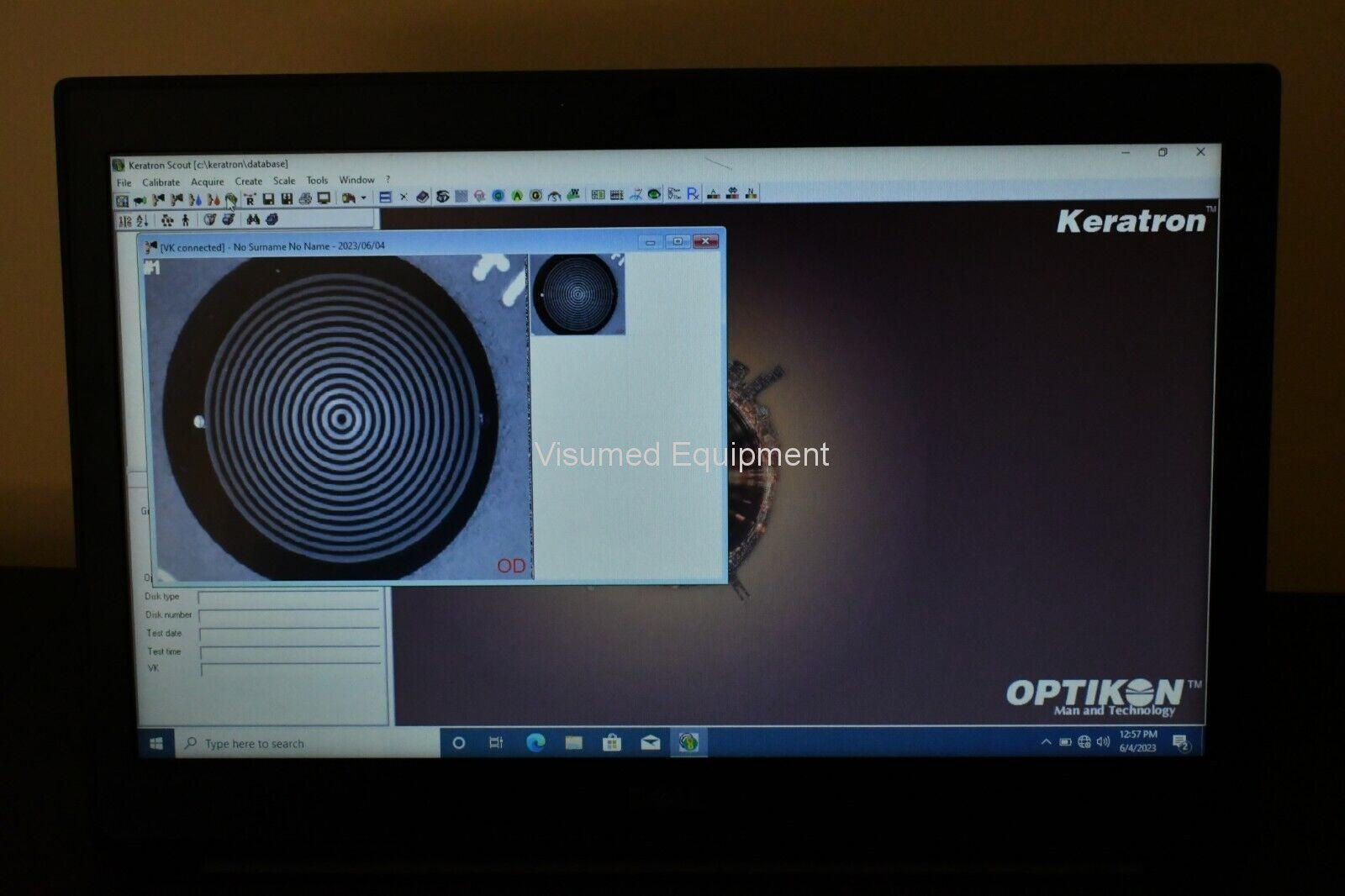 Refurbished Optikon Keratron Scout portable Corneal Topographer offered by Visumed Equipment