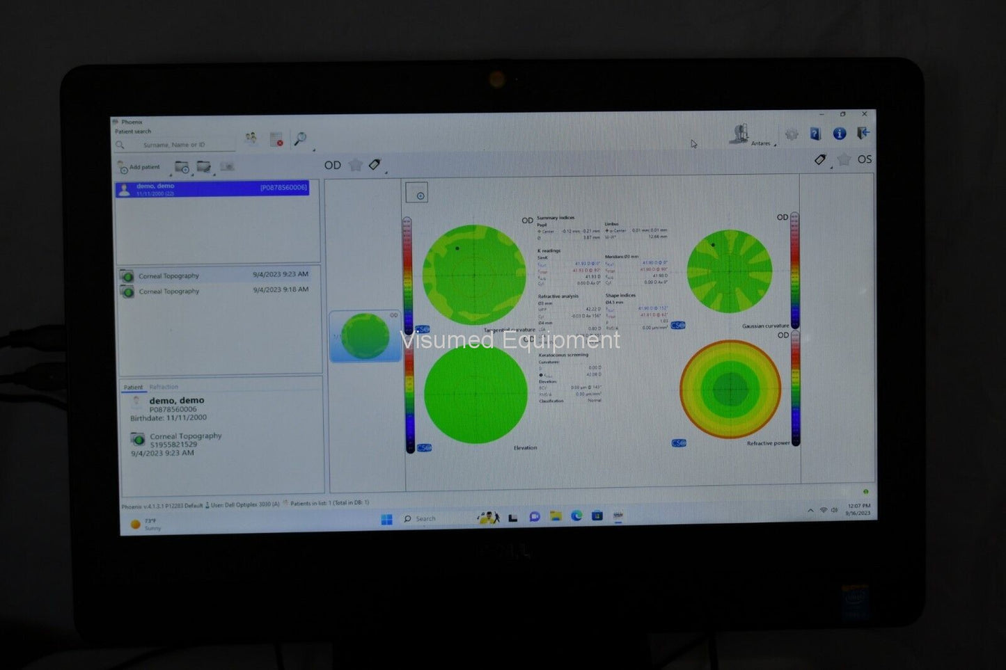 Refurbished Lumenis CSO Antares plus Corneal topography Meibomianography tear film offered by Visumed Equipment