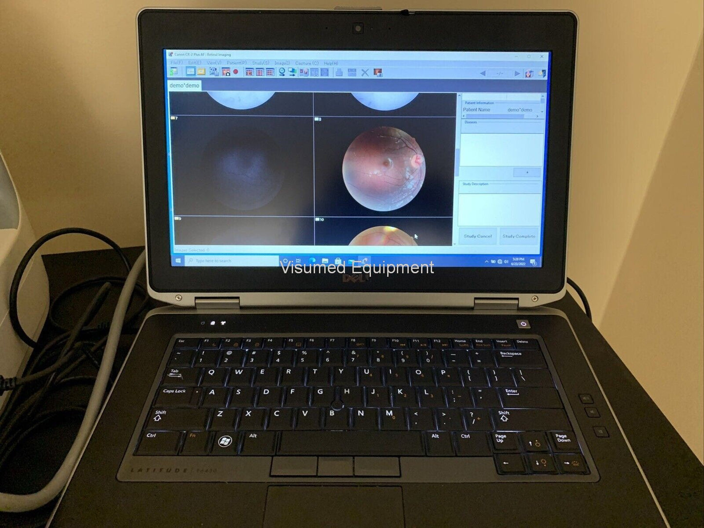 Refurbished Canon CR-2 Plus AF Camera Autofocus Fundus Autofluorescence offered by Visumed Equipment